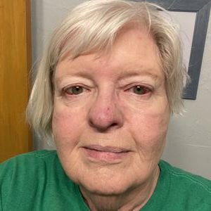 Bev Allen